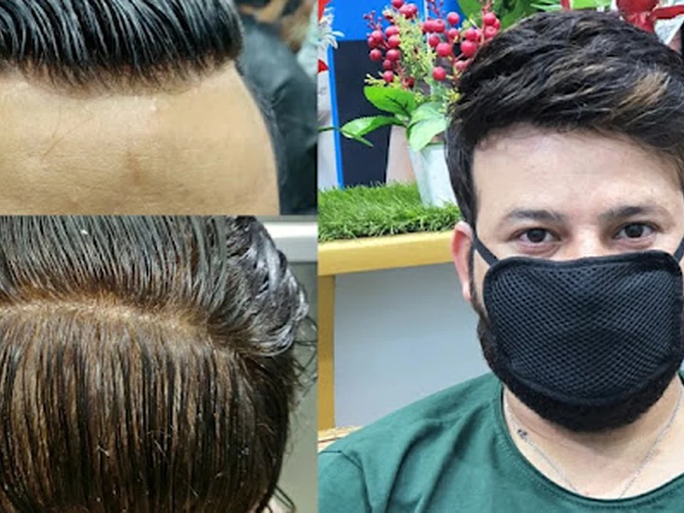 Anas Sheikh Hair Solution Mumbai