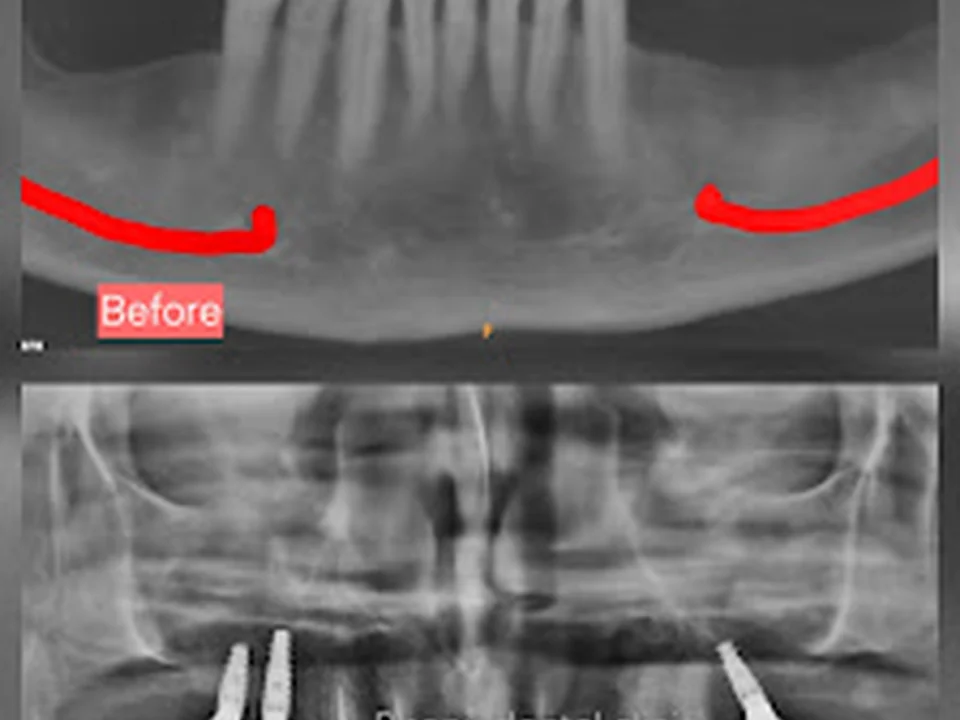 BHANU DENTAL CLINIC & IMPLANT CENTRE( Dr Vasant Bhanushali )