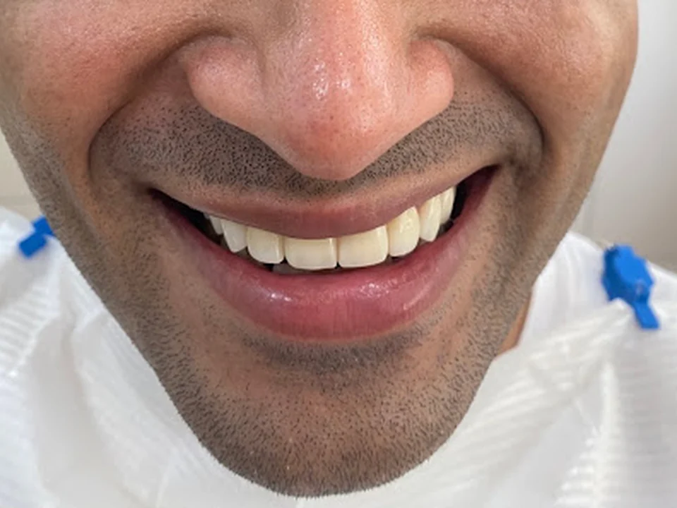 Dr. Aditi Chhajed Multispeciality Dental Centre, Implants