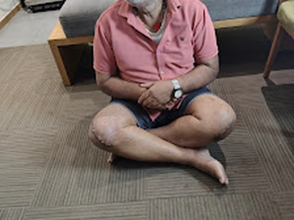 Dr. Anuj Singh orthopaedic knee replacement specialist Malad