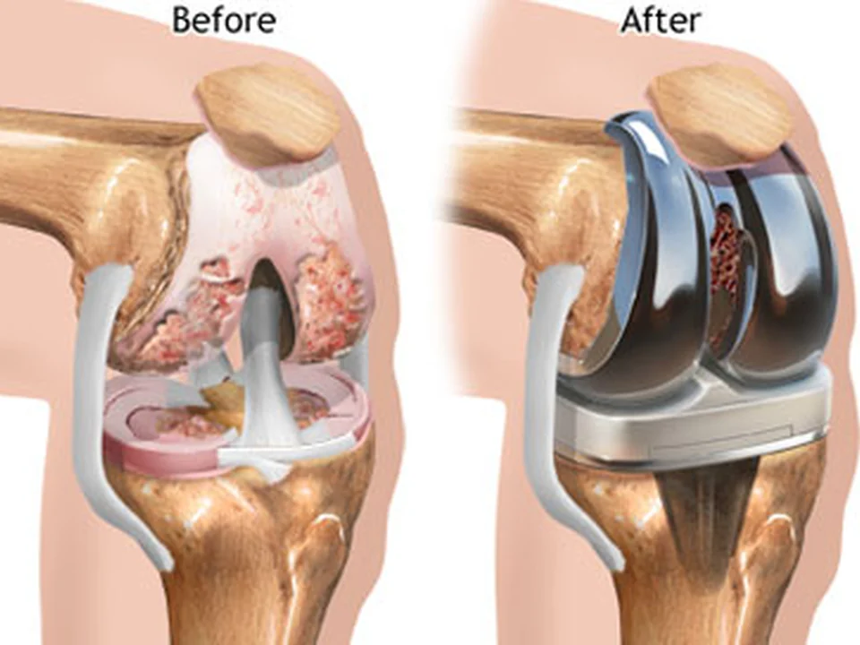 Dr.DINESH GUPTA (ORTHOPEDIC SURGEON)-Best Doctor For Hip & knee Replacement in Malad | Doctor For Orthopaedic in Malad