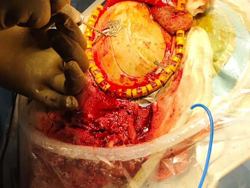 Dr. Kapil Khandelwal, neurosurgeon mumbai