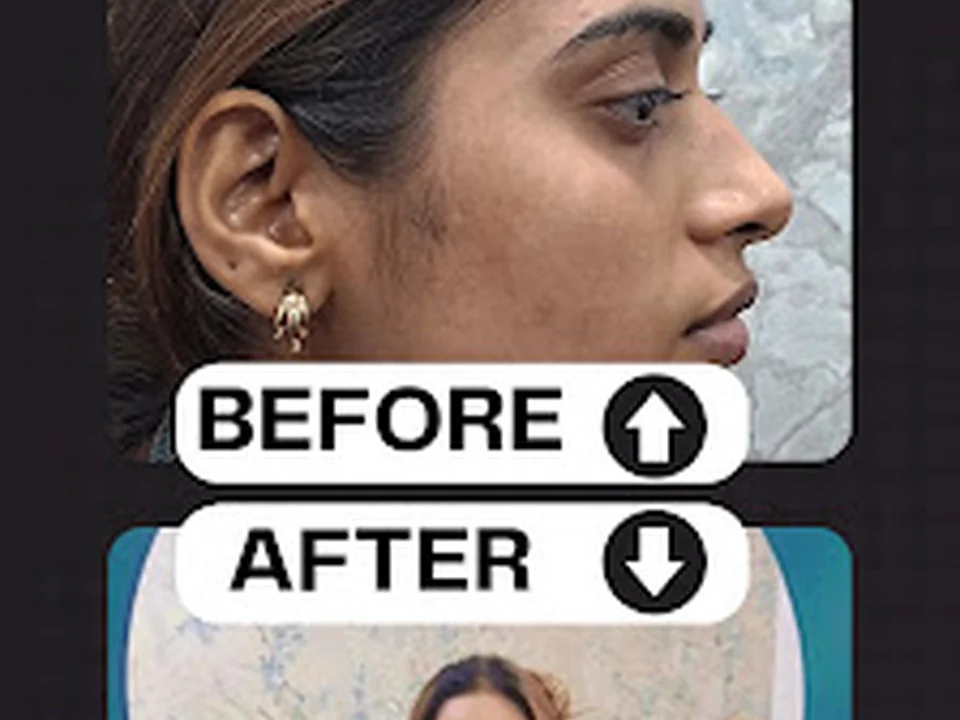 Dr. Samir Ahire | SA Aesthetics Clinic