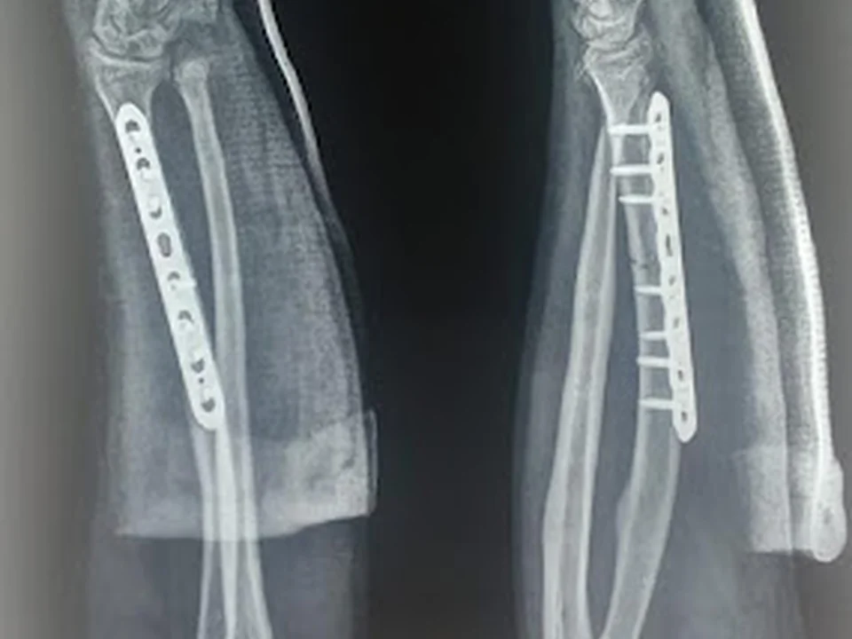 Dr. Sohail Khan | Hip, Knee & Shoulder Specialist|