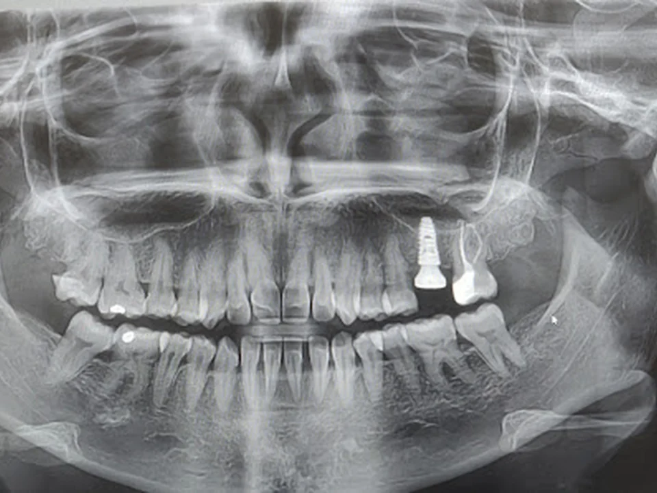 Jayshree Advanced Dental Clinic & Implant Centre Dr Pravin Dange