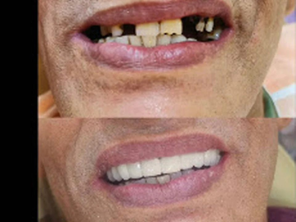 Masters of Dentistry MD DENTAL CLINIC Juhu