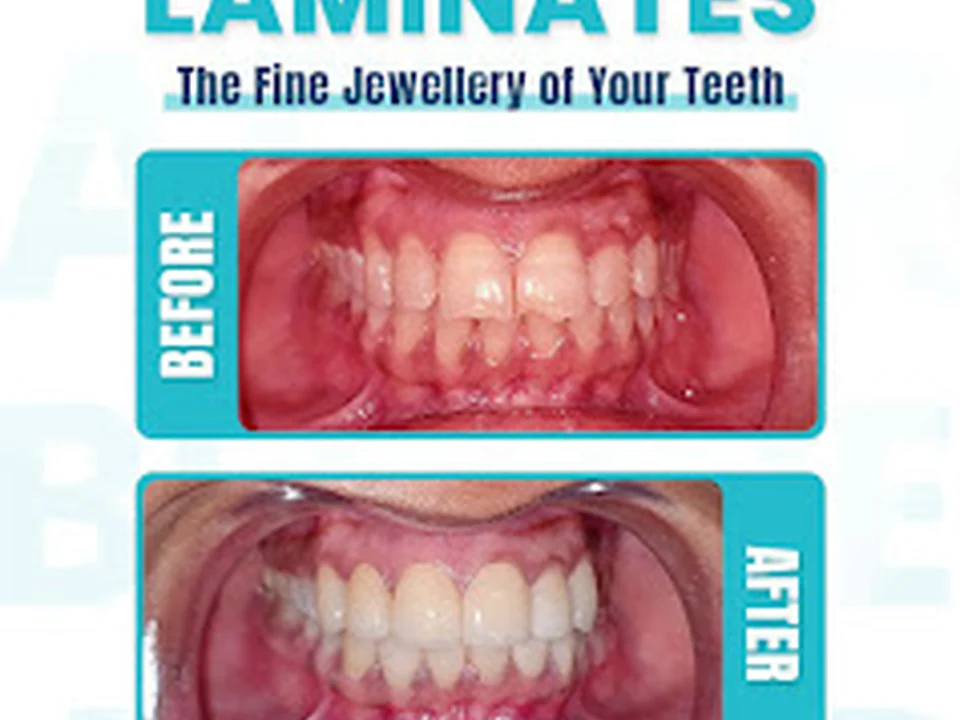 Om Datta Dental Clinic