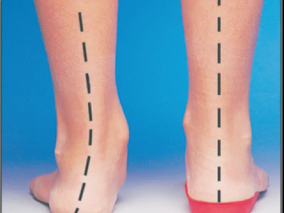 Stride Fitness and Mobility Clinic