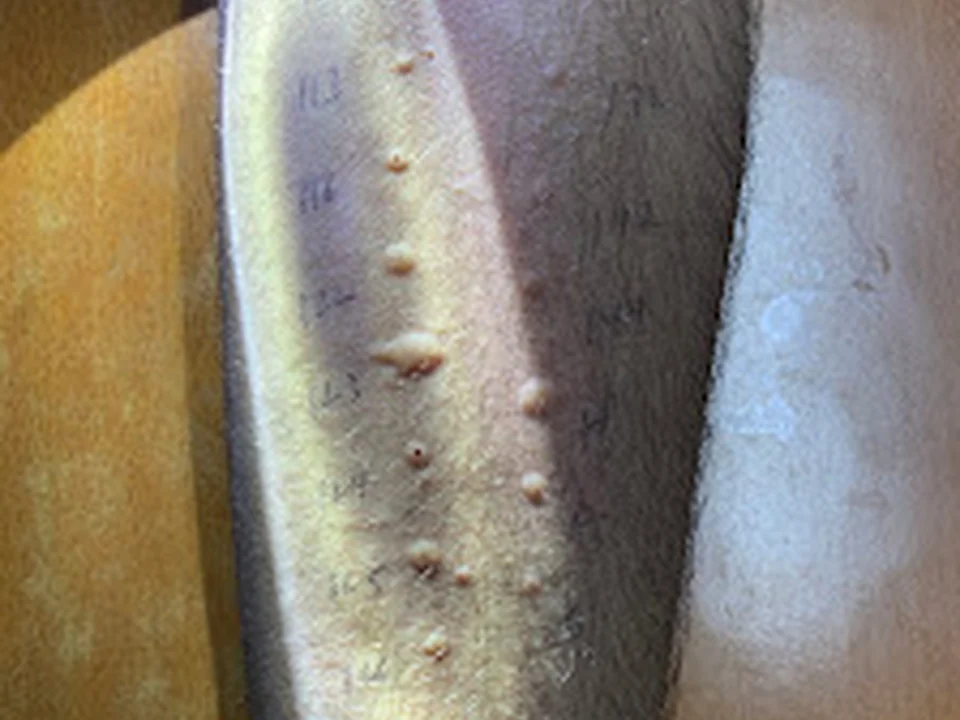 Viva Diagnostica Allergy Testing & Treatment Centre, Mumbai