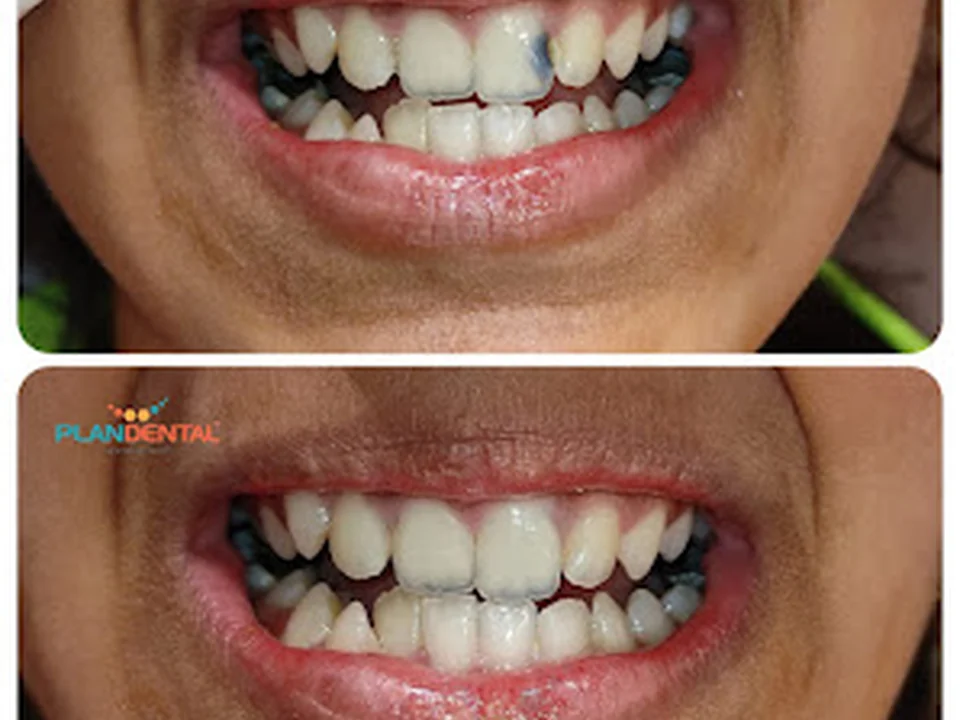 Plan Dental, Mumbai