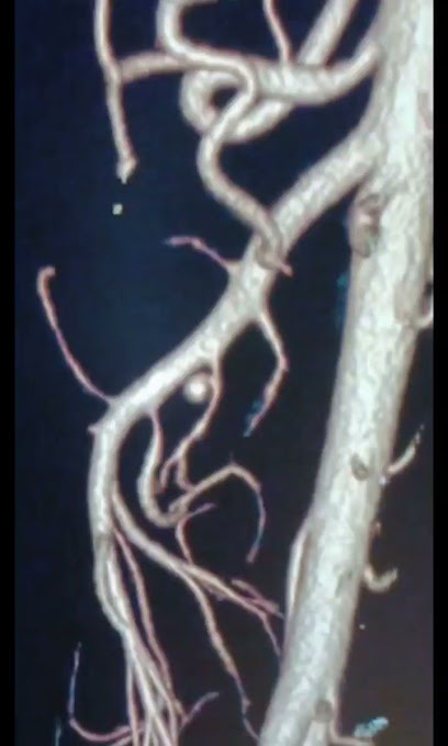 Dr. Aniruddha Bhuiyan (Vascular and Endovascular Surgeon)